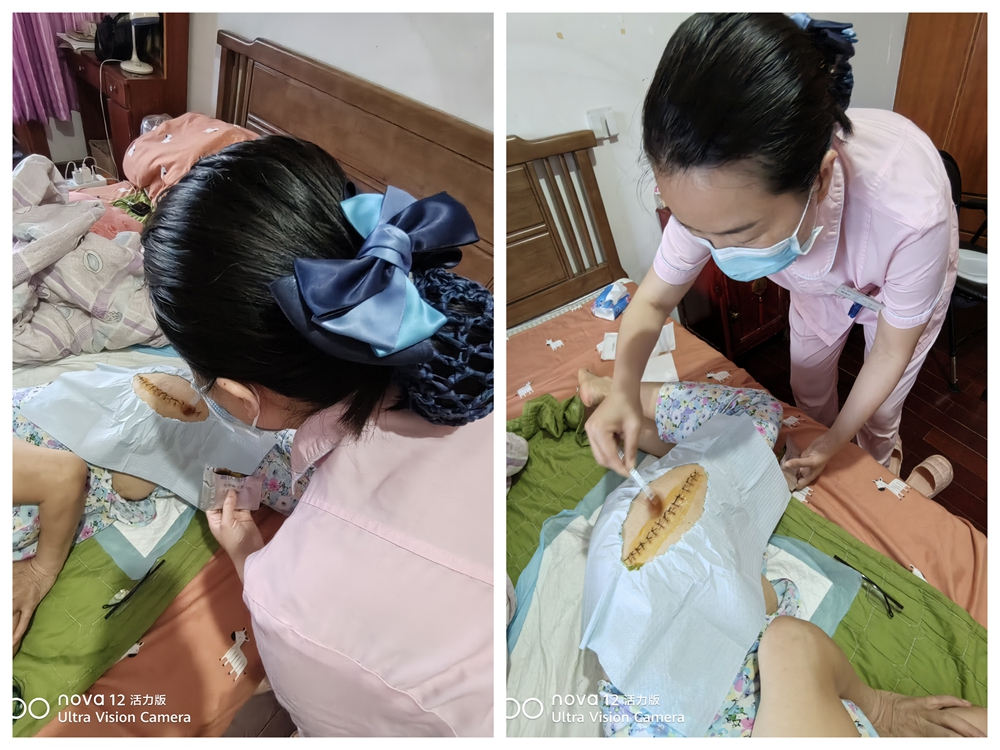 医者仁心进万家，志愿服务零距离｜家庭医生上门服务，化解术后康复“行路难”